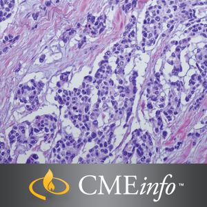 0001848 soft tissue tumors 300