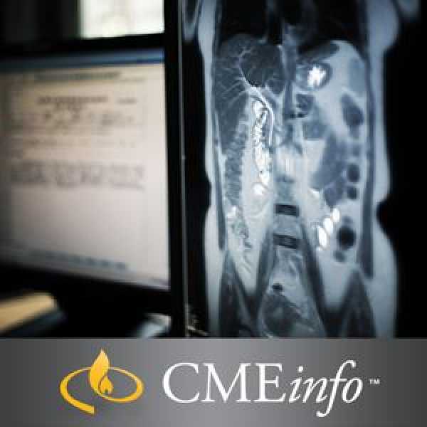 0002271 ucsf abdominal pelvic imaging 300 600x600 1
