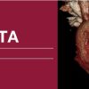 2018 Classic Lectures in Cardiac CTA