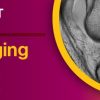 Knee Imaging Essentials 2022