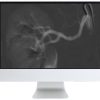 ARRS Case Based Subspecialty Review 2021 CME VIDEOS