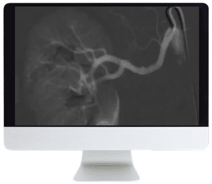 ARRS Case Based Subspecialty Review 2021 CME VIDEOS