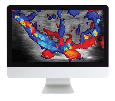 ARRS Thyroid Imaging 2019 ( VIDEOS)