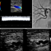 ASE Registered Physician in Vascular Interpretation RPVI Online Review Course 2023