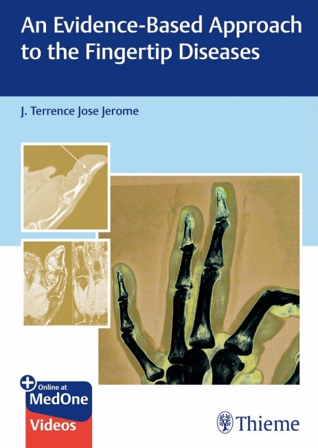 An Evidence Based Approach To The Fingertip Diseases
