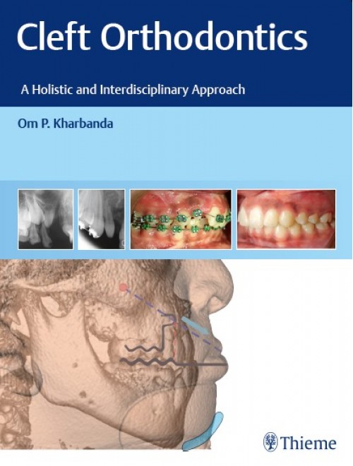 Cleft Orthodontics A Holistic And Interdisciplinary Approach Original PDF From Publisher