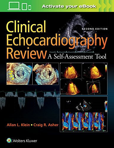 Clinical Echocardiography Review A Self Assessment Tool Second Edition pdf Only