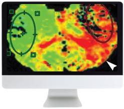 Code Stroke: What The Radiologist Needs To Know In The Changing Landscape Of Acute Ischemic Stroke 2019 (Videos)