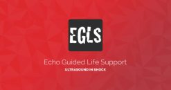 ECHO Guided Life Support Using ultrasound to categorise shock and guide initial management CME VIDEOS