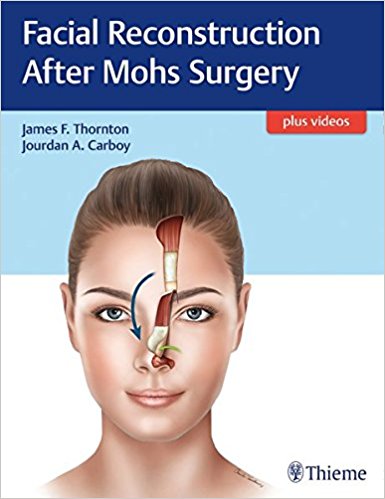 Facial Reconstruction After Mohs Surgery EPUB