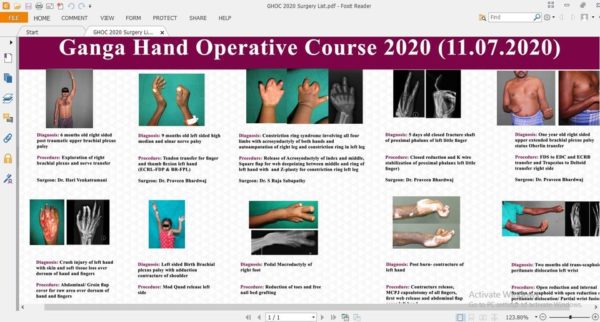Ganga Hand Microsurgery Operative Course 2020