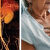 Harvard Diabetes Comorbidities And Complications 2024