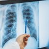 Harvard thoracic pathology 2024