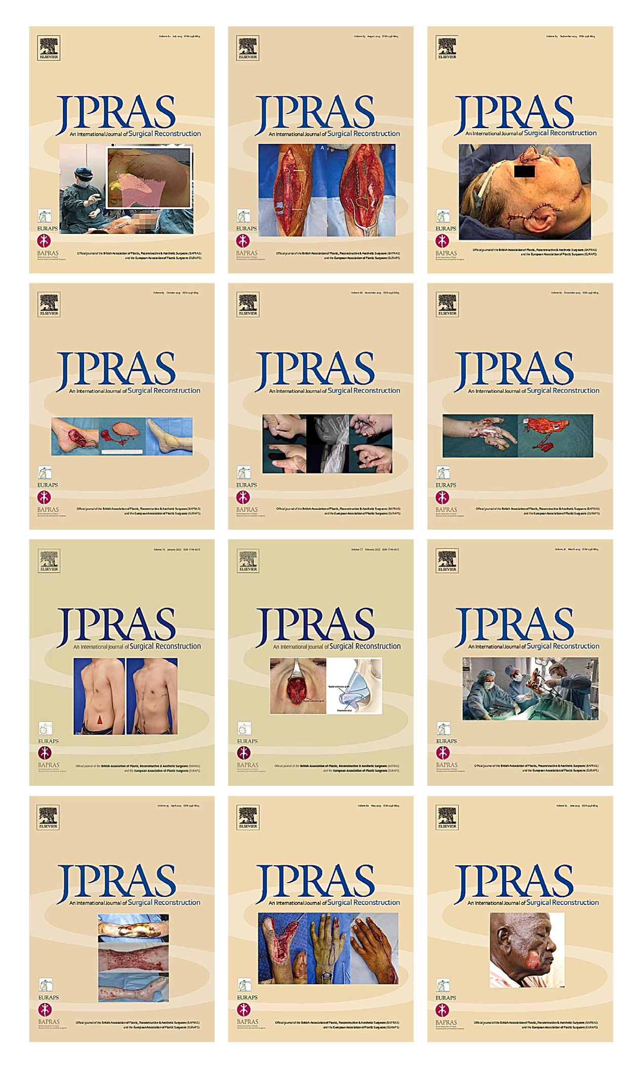Journal Of Plastic Reconstructive Aesthetic Surgery 2023 Full Archives True PDF