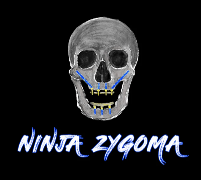 Ninja Zygoma – Implant Ninja Videos