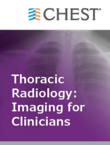 Thoracic Radiology Imaging for Clinicians Chestnet 2021 Videos Quiz