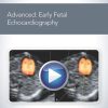 advanced early fetal echocardiography