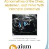 aium prenatal ultrasound abnormalities of the chest abdomen and pelvis with postnatal correlation medical video courses 565698 720x