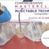 composite veneers injectable technique masterclass 510x340 1
