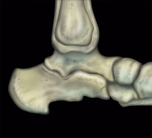 mri mastery series ankle 510x463 1