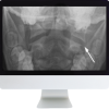 neuroradiology review for the practicing radiologist 2018