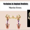occlusion in implant dentistry 510x288 2