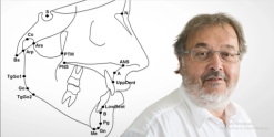 ohi s cephalometric analysis from a to z everything a dentist should know 2023 course 510x255 1