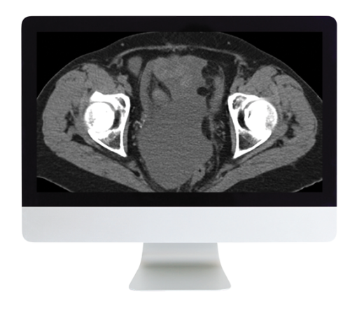 radiologic review lr 510x446 1
