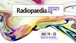 radiopedia 2021 510x287 1