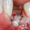 soft tissue2 1 624x351 1 510x287 1