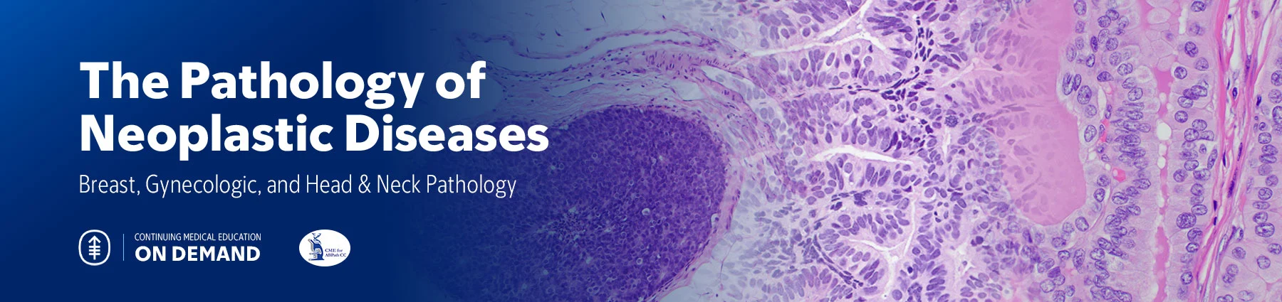 The Pathology of Neoplastic Diseases 2025 (Videos with subtitles + Slides)