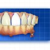 OHI-S Complete prosthetic protocols CADCAM CEREC