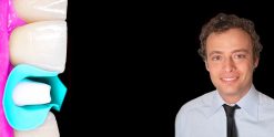OHI-S Full-mouth rehabilitation based on implants and natural teeth