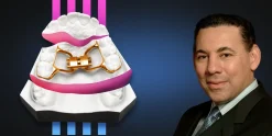 OHI-S Functional orthodontics. Autotransplantation. Result retention