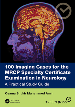 100 Imaging Cases for the MRCP Specialty Certificate Examination in Neurology (EPUB)
