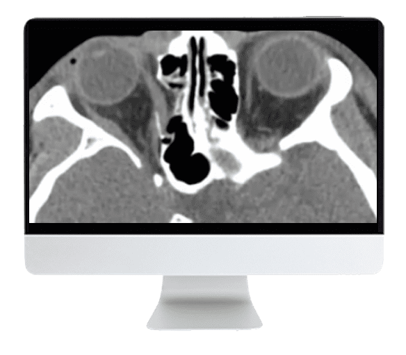 ARRS Imaging Victims of Violence: Fists, Stabs, Bullets, and Blasts 2021 (CME VIDEOS)