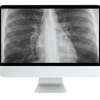 ARRS Cranial Nerve Imaging: From the Least to the Last 2022 ( Videos )