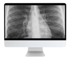 ARRS Liver, Pancreatic, and Biliary Tumors 2022 (Videos + CME Questions)