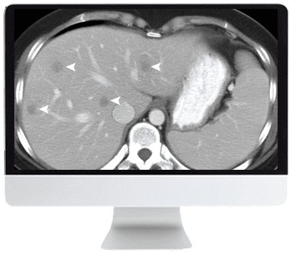 ARRS SAR Disease-Focused Panels: Cancer Imaging and Reporting Guidelines 2021 ( VIDEOS)