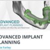 Advanced Implant Planning Course (Full Arch with Blue Sky and Meshmixer)