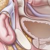 Cleveland Clinic Comprehensive Hernia Center 2019