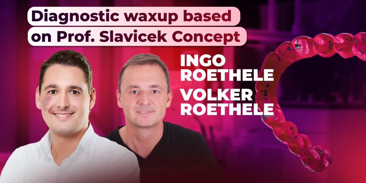 Diagnostic waxup based on Prof. Slavicek concept