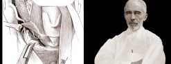 Harvard Surgery of the Thyroid and Parathyroid Gland 2022