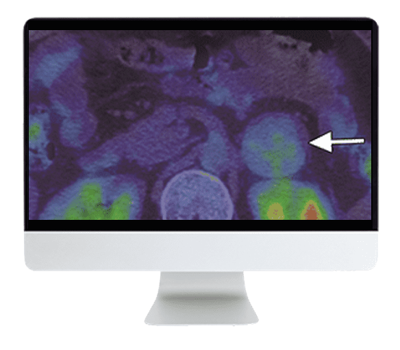 ARRS Breakthroughs in Nuclear Medicine for Neurology and Oncology 2021 ( VIDEOS)