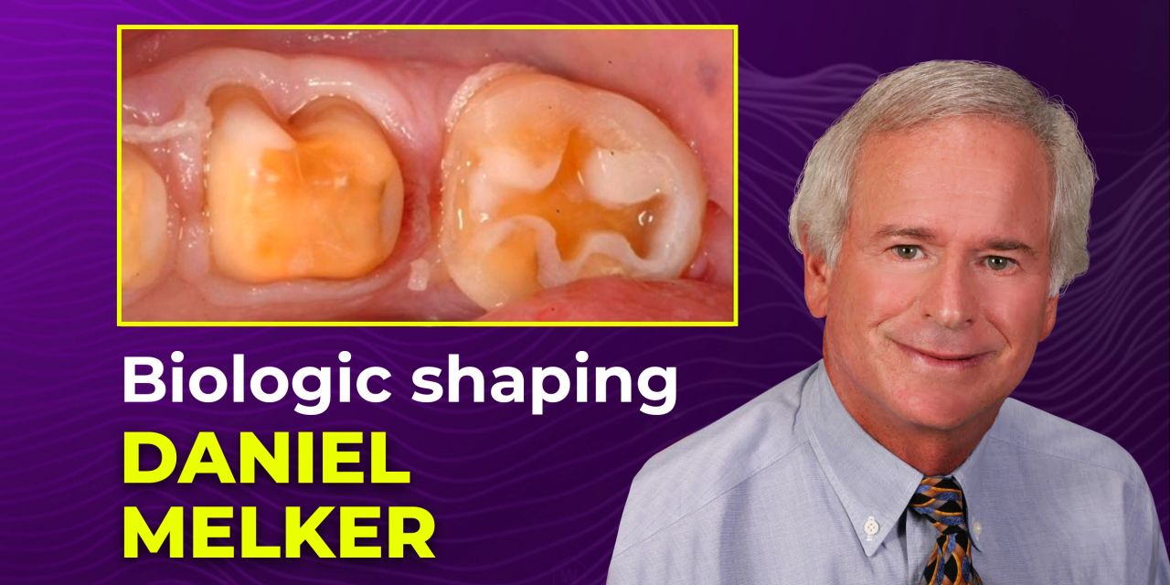 OHI-S Biologic Shaping a conservative alternative to crown lengthening 4 lessons 1h 54m
