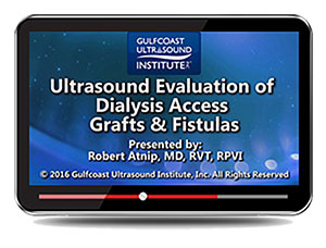 Ultrasound Evaluation of Dialysis Access Grafts and Fistula