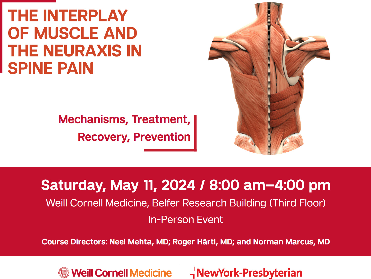 The Interplay of Muscle and the Neuraxis in Spine Pain 2024