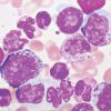 Hematopathology 2021