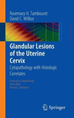Glandular Lesions of the Uterine Cervix: Cytopathology with Histologic Correlates(Publisher PDF)