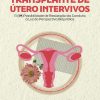 Transplante de Útero Intervivos: A (im)Possibilidade de Realização da Conduta à Luz da Perspectiva Biojurídica (Portuguese Edition) (EPUB and pdf)